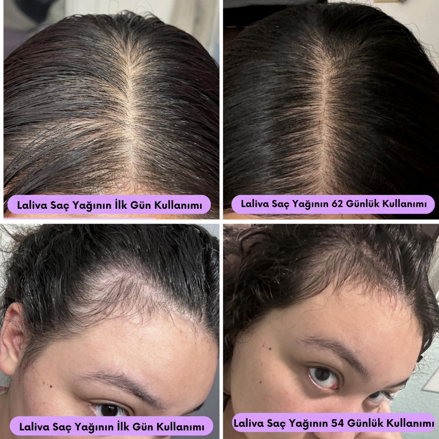 Laliva Doğal Saç Uzatma Serumu