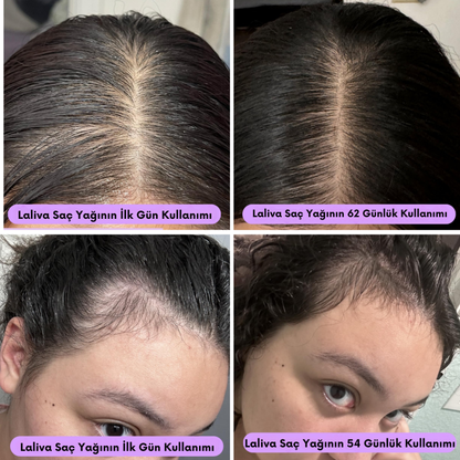 Laliva Doğal Saç Uzatma Serumu